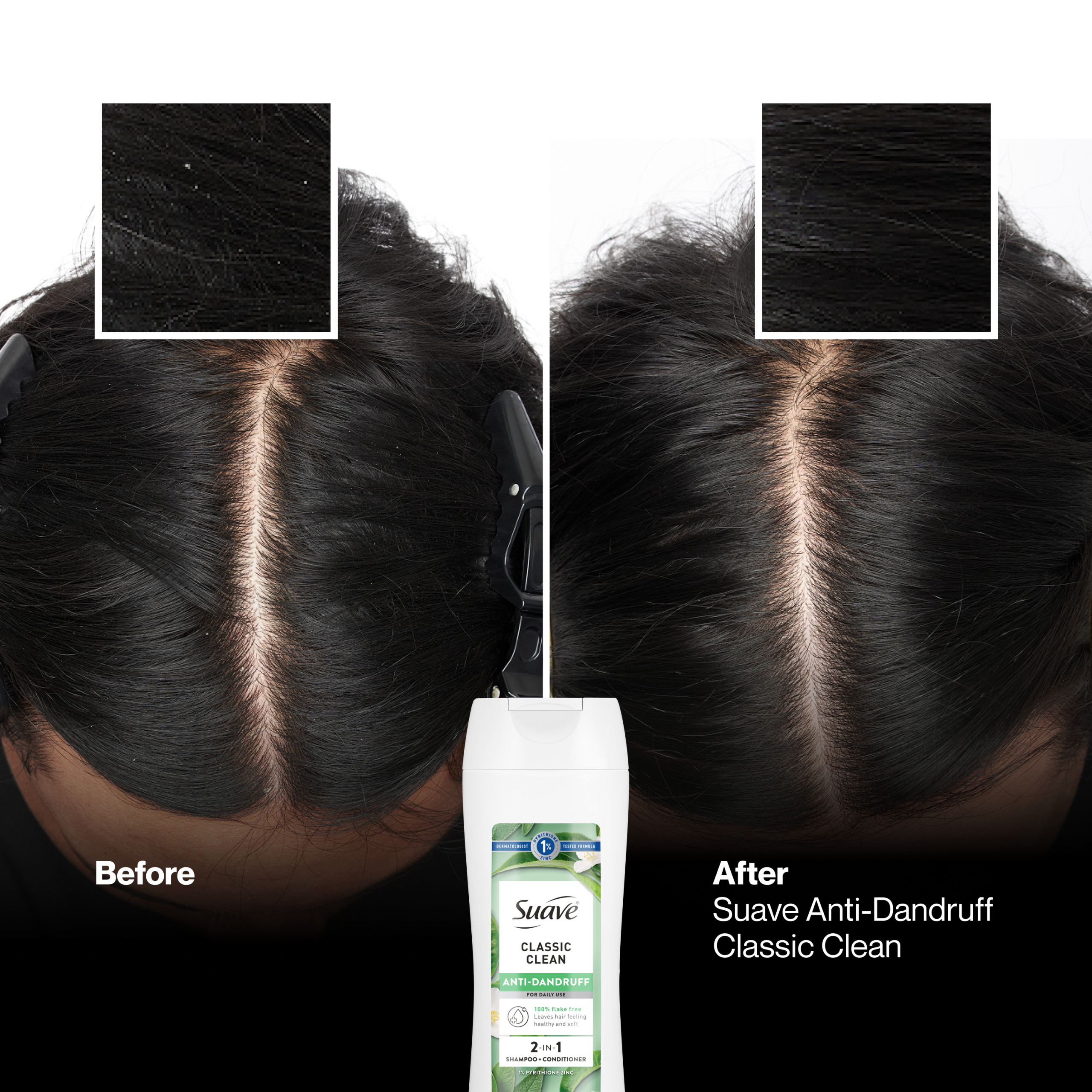 Classic Clean Anti Dandruff 2-in-1 Shampoo & Conditioner - Image 4